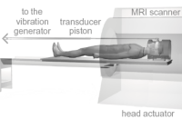 CCE (Computer-Controlled Elastography)